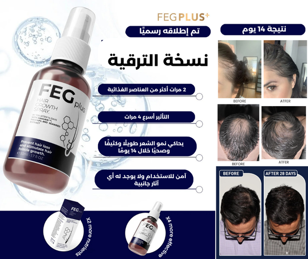 EFG Plus Hair Growth Spray