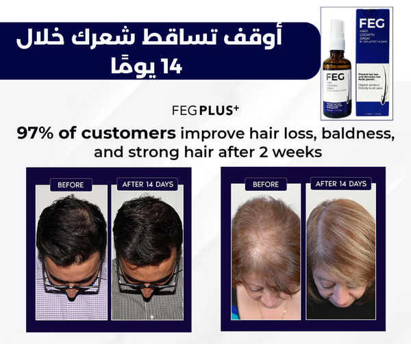 EFG Plus Hair Growth Spray